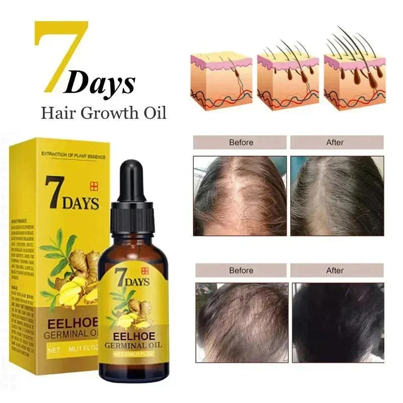 Ginger Hair Growth Serum Anti Hair Loss Fast Regrowth Hair Care Oil Repair Damaged Hair Treatment For Women Men