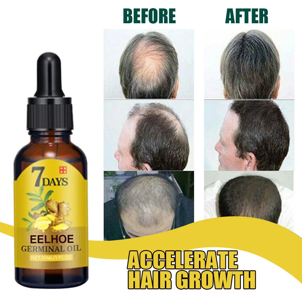 Ginger Hair Growth Serum Anti Hair Loss Fast Regrowth Hair Care Oil Repair Damaged Hair Treatment For Women Men