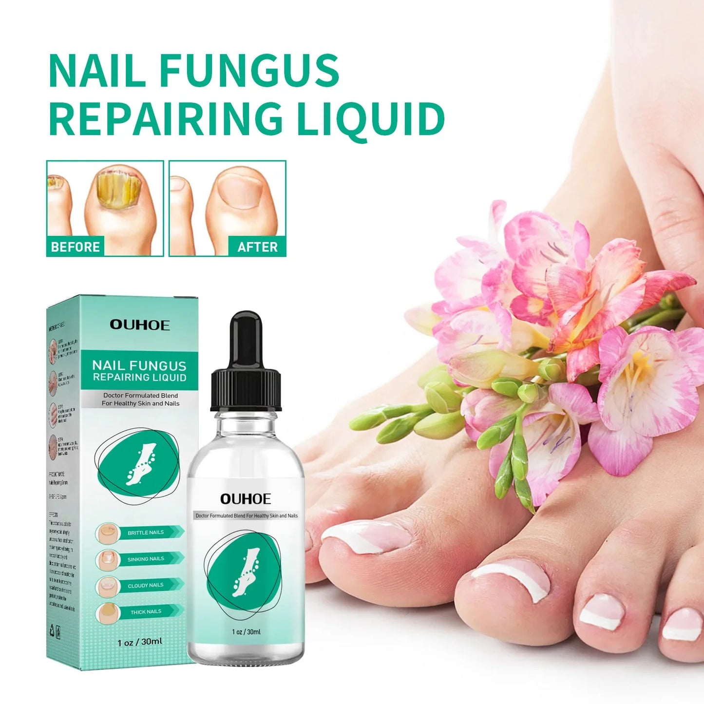 Nail fungus treatment gel |Herbal nail polish foot protection care oil