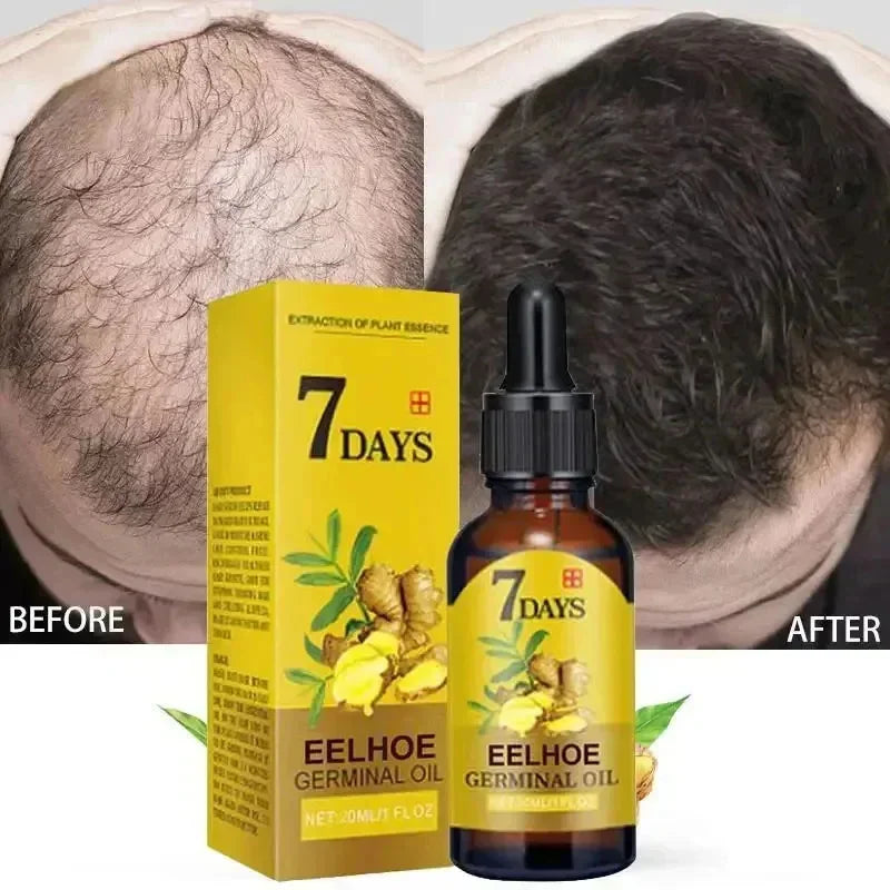 Ginger Hair Growth Serum Anti Hair Loss Fast Regrowth Hair Care Oil Repair Damaged Hair Treatment For Women Men