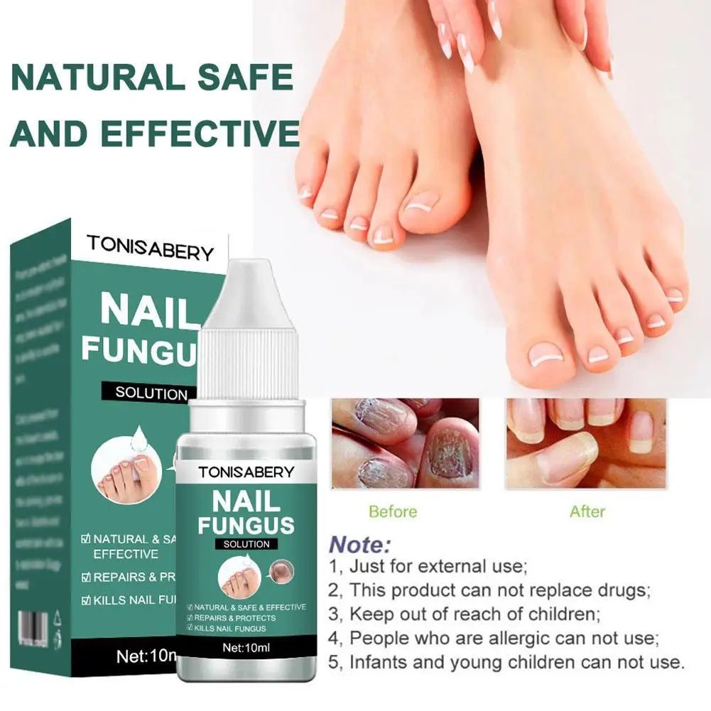 Nail Fungal Treatment Anti Infection Onychomycosis Removal